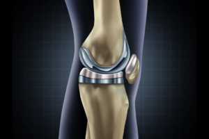 Copy of BODYLOGICS PHYSIO1 (3)